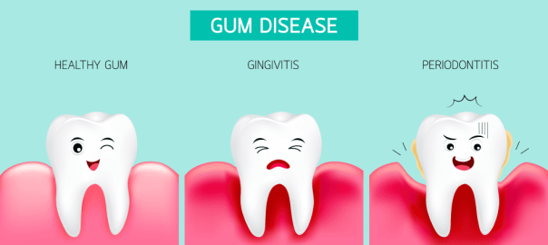 gum disease