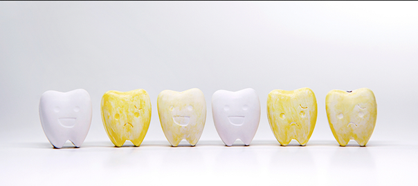 What Is Dental Fluorosis and How Is It Treated?